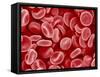 Human Red blood cells-Micro Discovery-Framed Stretched Canvas