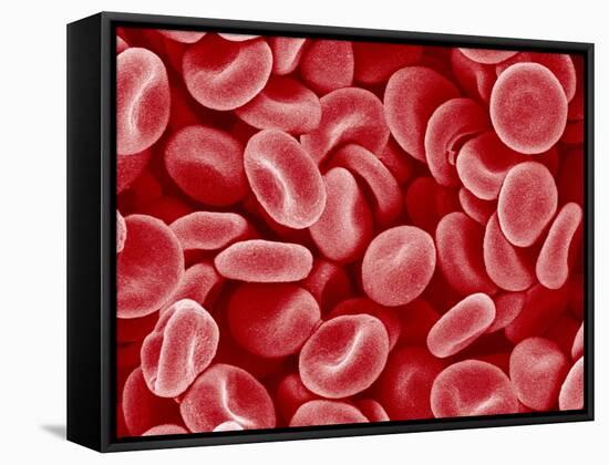 Human Red blood cells-Micro Discovery-Framed Stretched Canvas