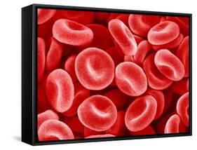 Human Red blood cells-Micro Discovery-Framed Stretched Canvas