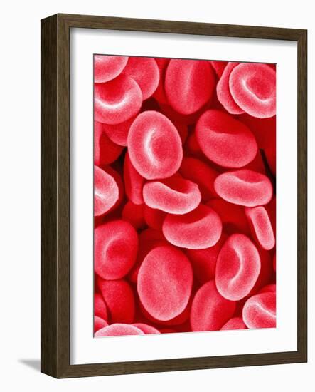 Human Red Blood Cells-Micro Discovery-Framed Photographic Print