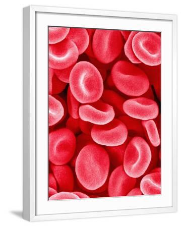 'Human Red Blood Cells' Photographic Print - Micro Discovery ...