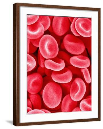 'Human Red Blood Cells' Photographic Print - Micro Discovery ...