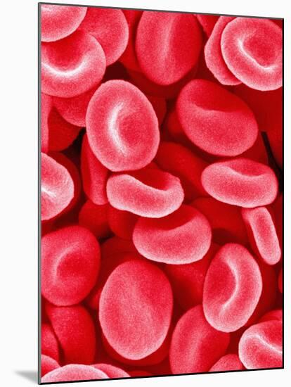 Human Red Blood Cells-Micro Discovery-Mounted Photographic Print