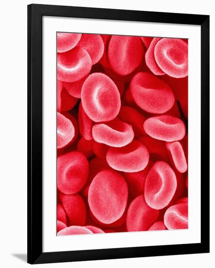 Human Red Blood Cells-Micro Discovery-Framed Photographic Print