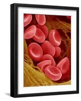 Human Red Blood Cells-Micro Discovery-Framed Photographic Print