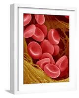 Human Red Blood Cells-Micro Discovery-Framed Photographic Print