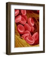 Human Red Blood Cells-Micro Discovery-Framed Photographic Print