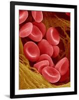 Human Red Blood Cells-Micro Discovery-Framed Photographic Print