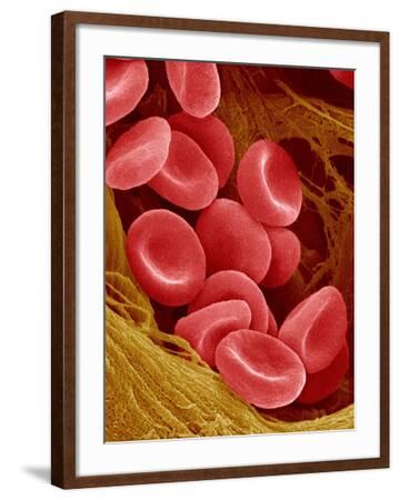 'Human Red Blood Cells' Photographic Print - Micro Discovery ...