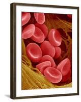 Human Red Blood Cells-Micro Discovery-Framed Photographic Print