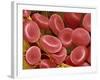 Human Red Blood Cells-Micro Discovery-Framed Photographic Print