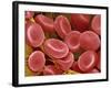 Human Red Blood Cells-Micro Discovery-Framed Photographic Print