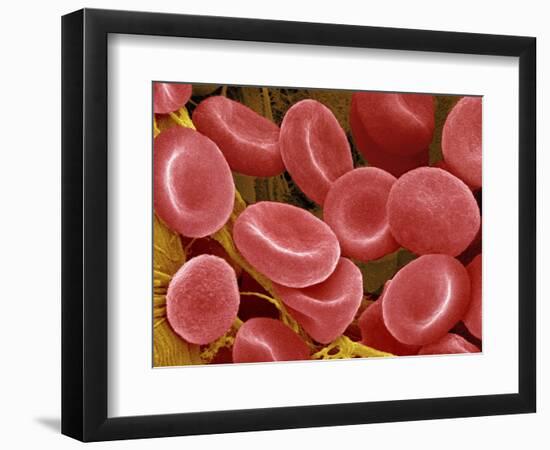 Human Red Blood Cells-Micro Discovery-Framed Photographic Print