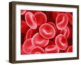 Human Red Blood Cells-Micro Discovery-Framed Photographic Print