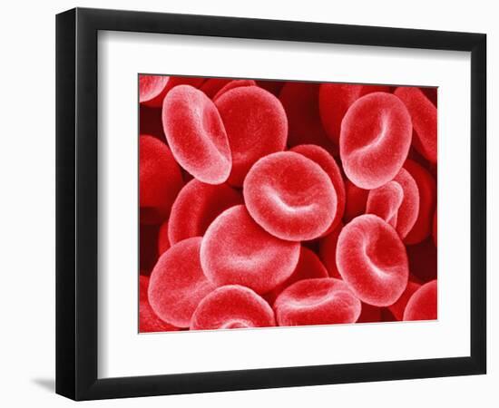 Human Red Blood Cells-Micro Discovery-Framed Photographic Print