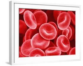 Human Red Blood Cells-Micro Discovery-Framed Photographic Print