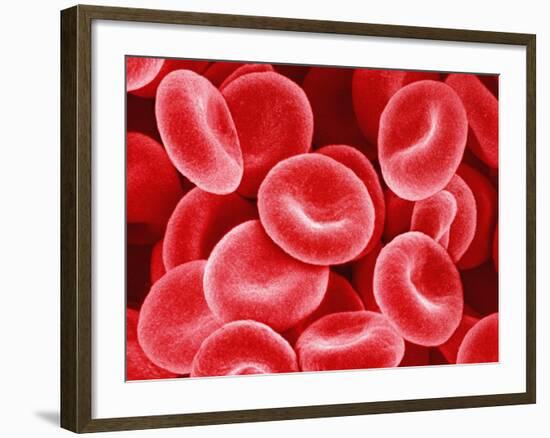 Human Red Blood Cells-Micro Discovery-Framed Photographic Print