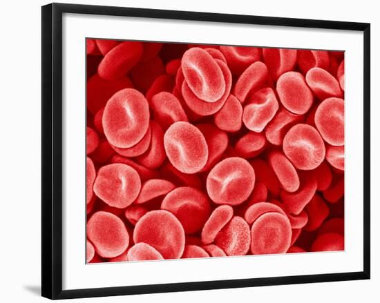 Human Red blood cells-Micro Discovery-Framed Photographic Print