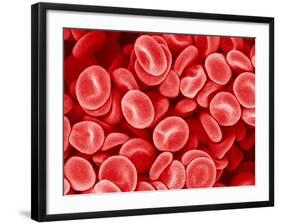 Human Red blood cells-Micro Discovery-Framed Photographic Print