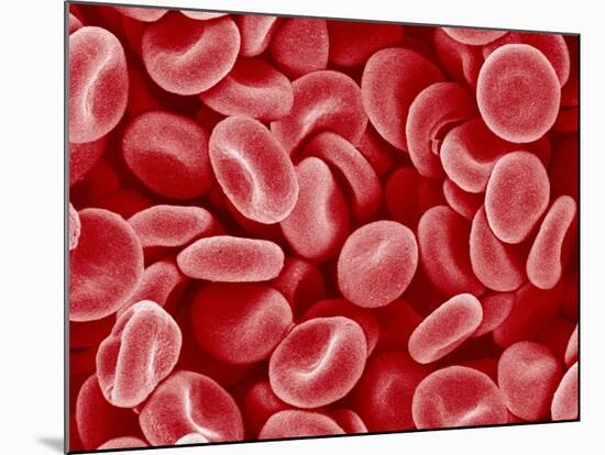 Human Red blood cells-Micro Discovery-Mounted Photographic Print