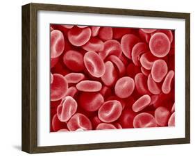 Human Red blood cells-Micro Discovery-Framed Photographic Print