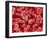 Human Red blood cells-Micro Discovery-Framed Photographic Print