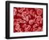 Human Red blood cells-Micro Discovery-Framed Photographic Print