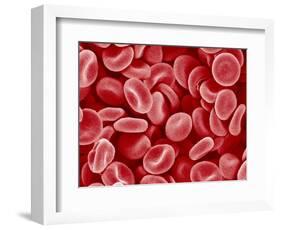 Human Red blood cells-Micro Discovery-Framed Photographic Print