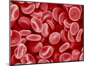 Human Red blood cells-Micro Discovery-Mounted Photographic Print