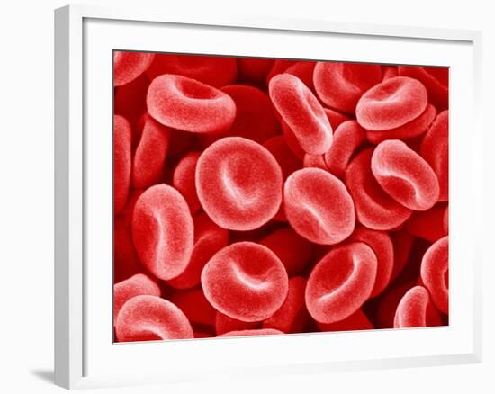 Human Red blood cells-Micro Discovery-Framed Photographic Print