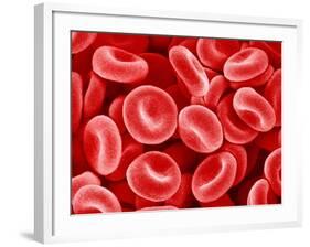 Human Red blood cells-Micro Discovery-Framed Photographic Print