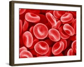 Human Red blood cells-Micro Discovery-Framed Photographic Print