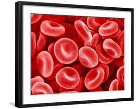 Human Red blood cells-Micro Discovery-Framed Photographic Print