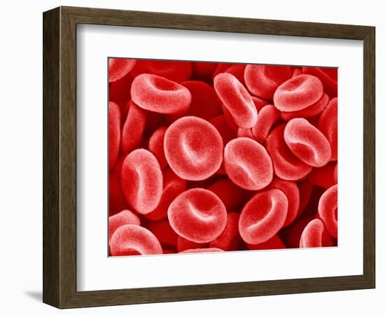 Human Red blood cells-Micro Discovery-Framed Photographic Print