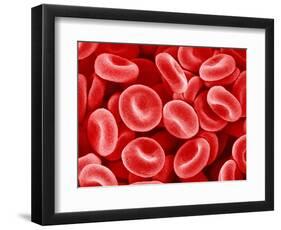 Human Red blood cells-Micro Discovery-Framed Photographic Print