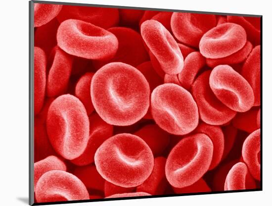 Human Red blood cells-Micro Discovery-Mounted Photographic Print