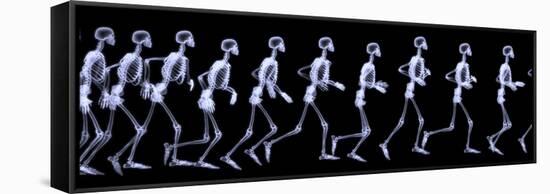 Human Skelegon Running, Radigraphy Sequence-riccardocova-Framed Stretched Canvas