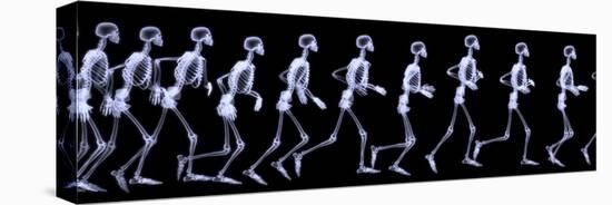 Human Skelegon Running, Radigraphy Sequence-riccardocova-Stretched Canvas