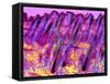 Human Skin, Polarised Light Micrograph-Dr. Keith Wheeler-Framed Stretched Canvas