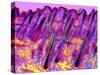 Human Skin, Polarised Light Micrograph-Dr. Keith Wheeler-Stretched Canvas