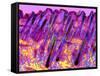 Human Skin, Polarised Light Micrograph-Dr. Keith Wheeler-Framed Stretched Canvas