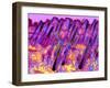 Human Skin, Polarised Light Micrograph-Dr. Keith Wheeler-Framed Premium Photographic Print