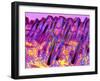 Human Skin, Polarised Light Micrograph-Dr. Keith Wheeler-Framed Premium Photographic Print