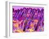 Human Skin, Polarised Light Micrograph-Dr. Keith Wheeler-Framed Premium Photographic Print