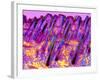 Human Skin, Polarised Light Micrograph-Dr. Keith Wheeler-Framed Photographic Print