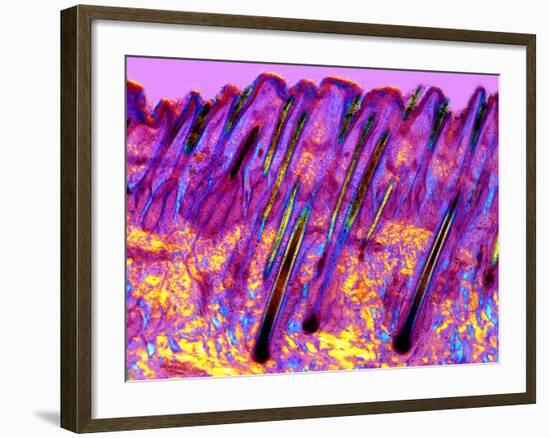 Human Skin, Polarised Light Micrograph-Dr. Keith Wheeler-Framed Photographic Print