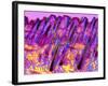Human Skin, Polarised Light Micrograph-Dr. Keith Wheeler-Framed Photographic Print