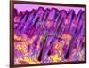 Human Skin, Polarised Light Micrograph-Dr. Keith Wheeler-Framed Photographic Print