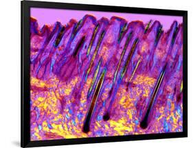 Human Skin, Polarised Light Micrograph-Dr. Keith Wheeler-Framed Photographic Print