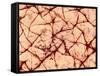 Human Skin Surface, SEM-Susumu Nishinaga-Framed Stretched Canvas